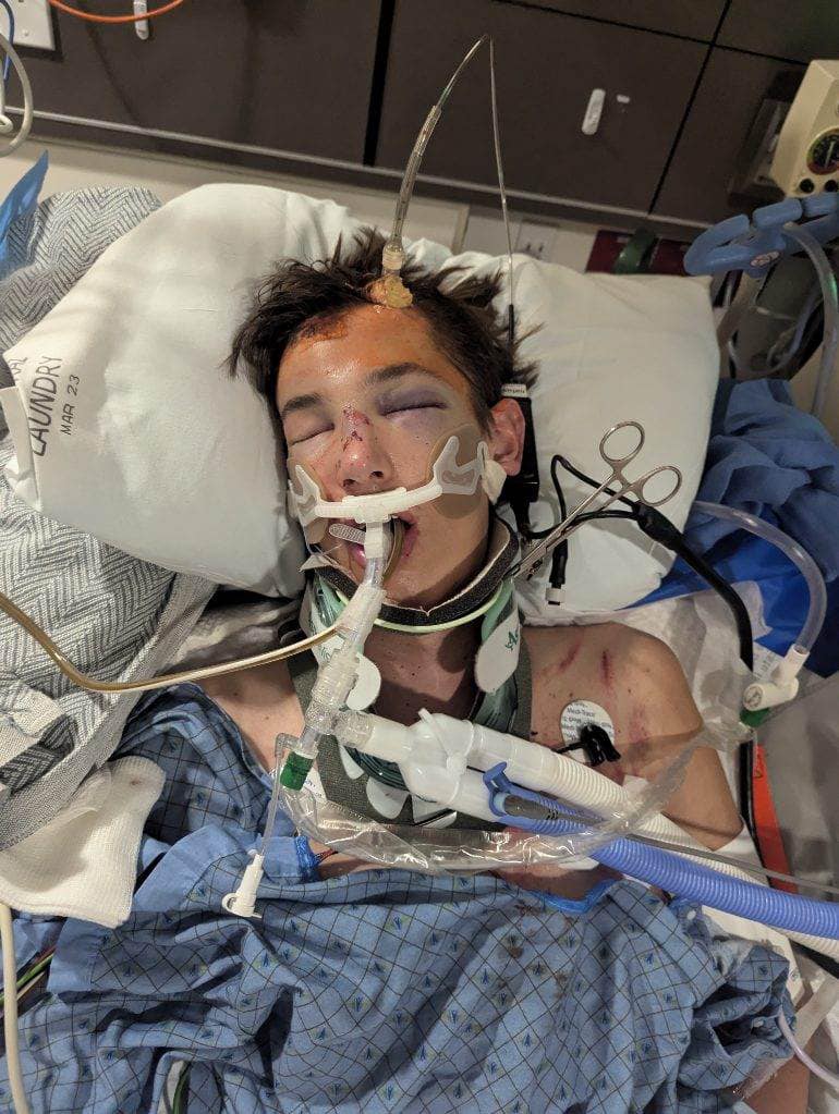 Trevor Higgins Accident:17-year-old high school senior injured in UTV crash